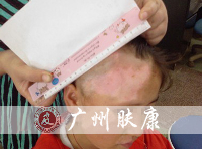 ���ݷ���Ƥ����ҽԺ