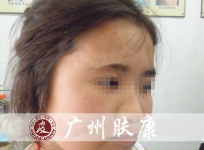 ���ݷ���Ƥ����ҽԺ