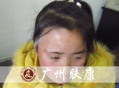 ���ݷ���Ƥ����ҽԺ