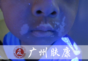 ���ݷ���Ƥ����ҽԺ