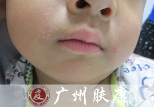 ���ݷ���Ƥ����ҽԺ