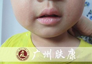 ���ݷ���Ƥ����ҽԺ