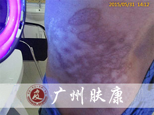 ���ݷ���Ƥ����ҽԺ