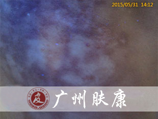 ���ݷ���Ƥ����ҽԺ