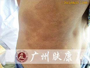 ���ݷ���Ƥ����ҽԺ