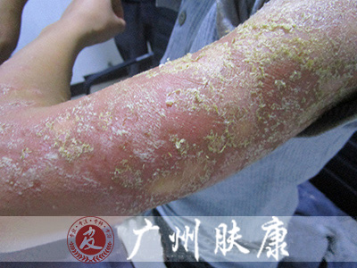 ���ݷ���Ƥ����ҽԺ