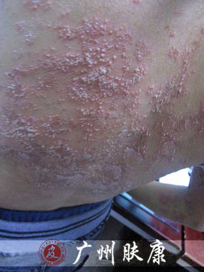 ���ݷ���Ƥ����ҽԺ