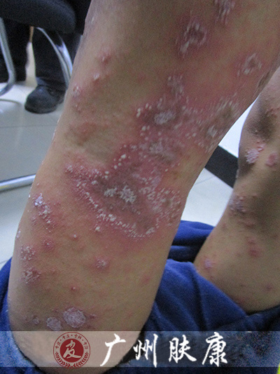 ���ݷ���Ƥ����ҽԺ