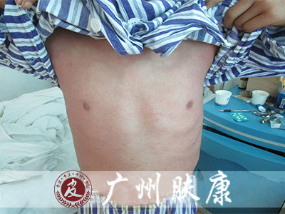 ���ݷ���Ƥ����ҽԺ