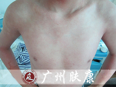 ���ݷ���Ƥ����ҽԺ