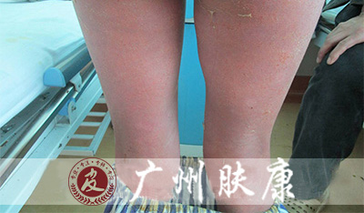 ���ݷ���Ƥ����ҽԺ