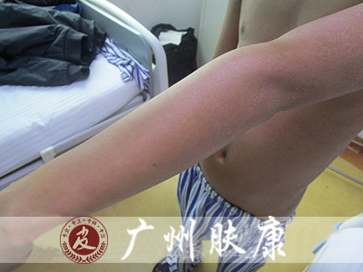 ���ݷ���Ƥ����ҽԺ