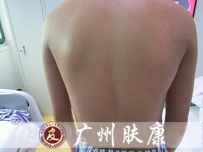 ���ݷ���Ƥ����ҽԺ