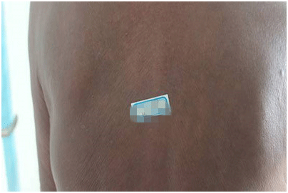 广州肤康皮肤病医院