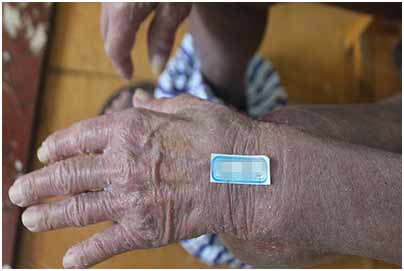 广州肤康皮肤病医院