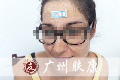 ���ݷ���Ƥ����ҽԺ