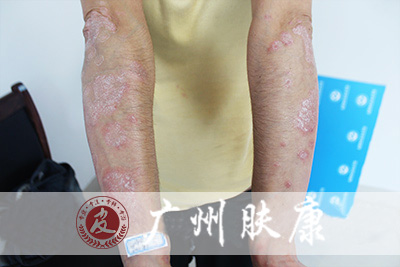 ���ݷ���Ƥ����ҽԺ