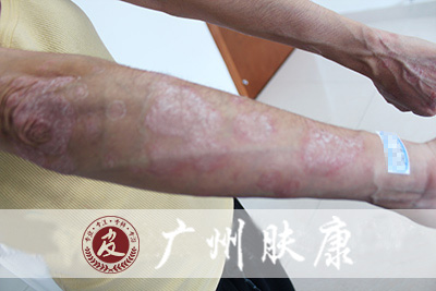 ���ݷ���Ƥ����ҽԺ