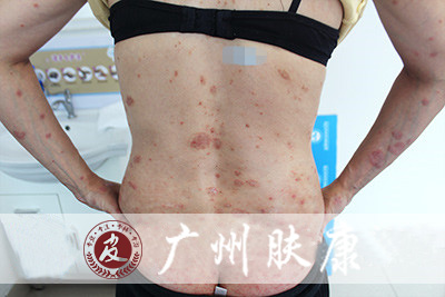 ���ݷ���Ƥ����ҽԺ