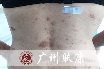 ���ݷ���Ƥ����ҽԺ