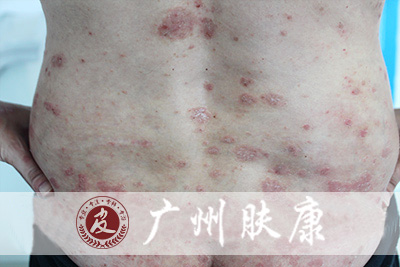 ���ݷ���Ƥ����ҽԺ