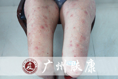 ���ݷ���Ƥ����ҽԺ