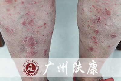 ���ݷ���Ƥ����ҽԺ