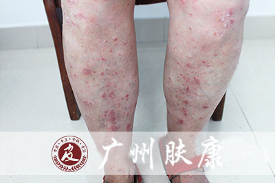 ���ݷ���Ƥ����ҽԺ