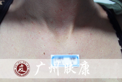 ���ݷ���Ƥ����ҽԺ