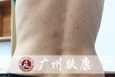 ���ݷ���Ƥ����ҽԺ