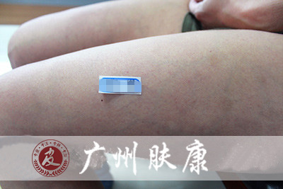 ���ݷ���Ƥ����ҽԺ