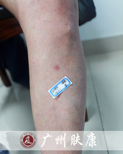 ���ݷ���Ƥ����ҽԺ