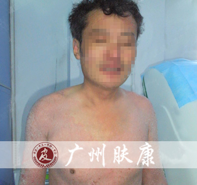 ���ݷ���Ƥ����ҽԺ