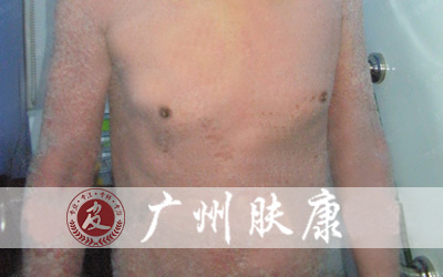 ���ݷ���Ƥ����ҽԺ