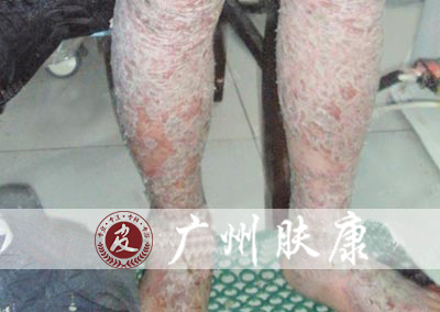 ���ݷ���Ƥ����ҽԺ