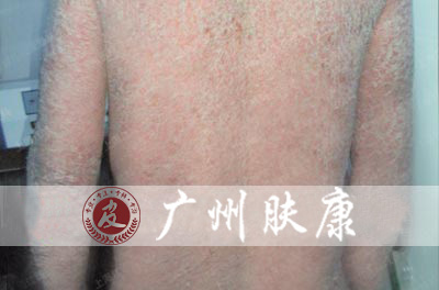 ���ݷ���Ƥ����ҽԺ