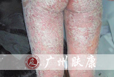 ���ݷ���Ƥ����ҽԺ