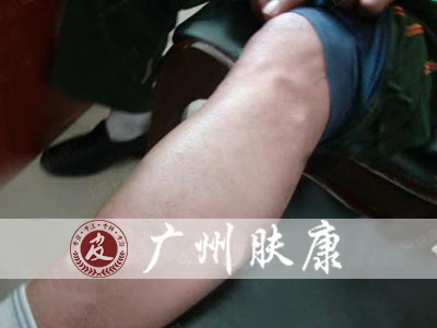 ���ݷ���Ƥ����ҽԺ