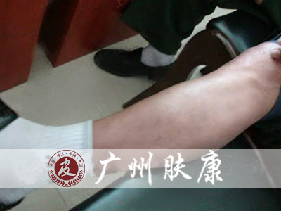 ���ݷ���Ƥ����ҽԺ