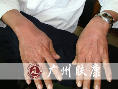 ���ݷ���Ƥ����ҽԺ