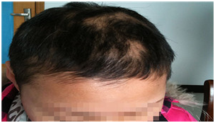 广州肤康皮肤病医院