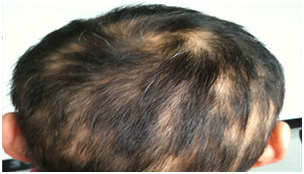 广州肤康皮肤病医院