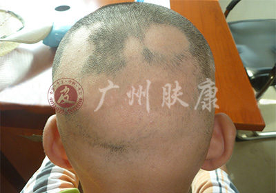 ���ݷ���Ƥ����ҽԺ