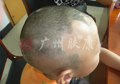 ���ݷ���Ƥ����ҽԺ