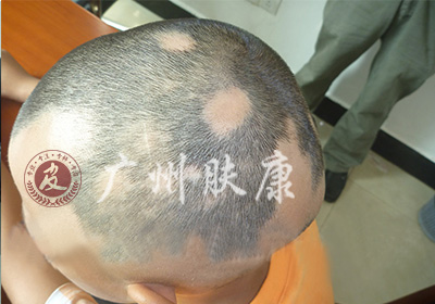 ���ݷ���Ƥ����ҽԺ