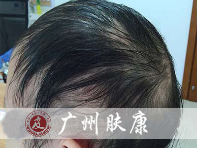 ���ݷ���Ƥ����ҽԺ