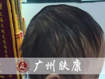 ���ݷ���Ƥ����ҽԺ