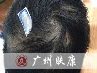 ���ݷ���Ƥ����ҽԺ