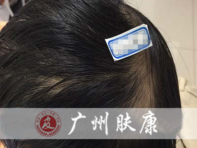 ���ݷ���Ƥ����ҽԺ