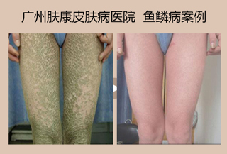 ���ݷ���Ƥ����ҽԺ